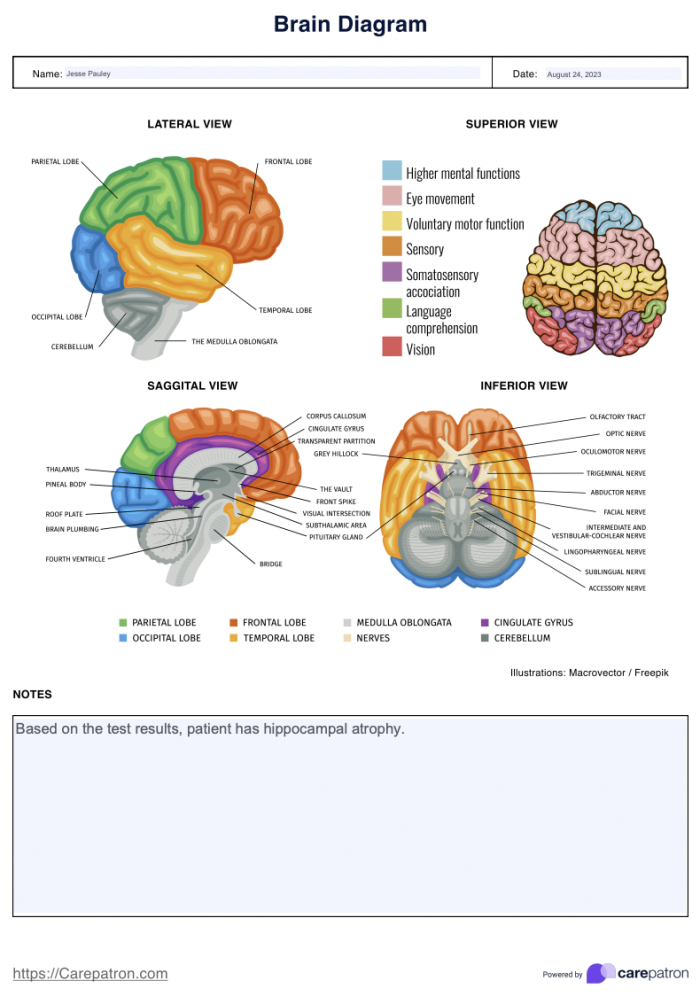Fourth Grade Your Brain worksheet illustrating basic brain functions in a fun geometry activity